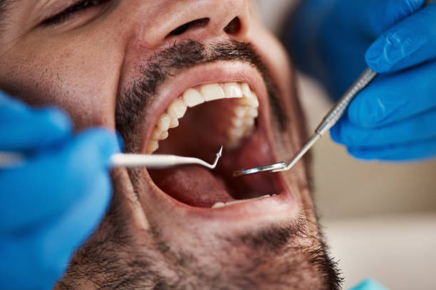 Best Broken or Chipped Tooth Repair in Sutherland, NE
