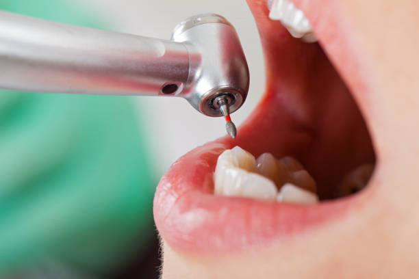 Best Emergency Denture Repair in Sutherland, NE